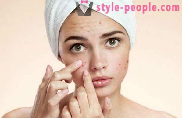 Ali je možno, da obrišite obraz vodikovega peroksida? Vodikov peroksid obrazne gube, akne in starostnih peg