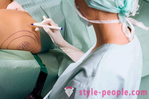 Plastični kirurgi uničiti stereotipi o svojem delu