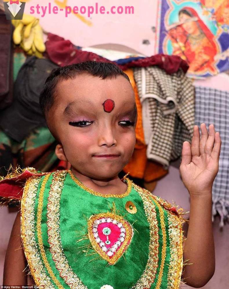 Indijski Vas častili fant z deformirano glavo kot boga Ganesha