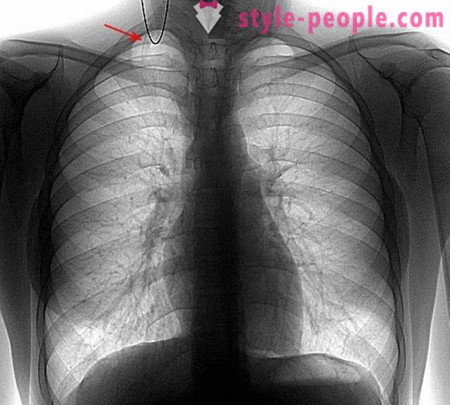 10 nenavadnih in nepričakovanih dejstev o telesnih organov človekovih