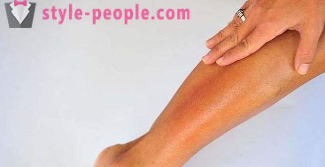 Suha koža na nogah: Vzroki